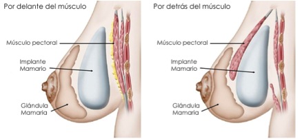 imagen_en_posicion